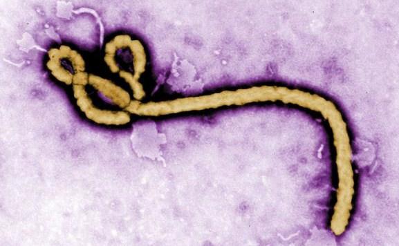 Brasil tem o primeiro caso suspeito de ebola em Cascavel, no Paraná